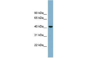 WB Suggested Anti-B4GALT2  Antibody Titration: 0. (B4GALT2 抗体  (Middle Region))