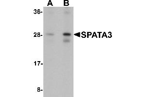 Western Blotting (WB) image for anti-Spermatogenesis Associated 3 (SPATA3) (C-Term) antibody (ABIN1077366) (SPATA3 抗体  (C-Term))