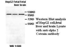 Image no. 1 for anti-Catenin (Cadherin-Associated Protein), alpha 2 (CTNNA2) antibody (ABIN6583527) (CTNNA2 抗体)