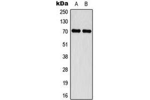 Western blot analysis of Merlin (pS518) expression in MCF7 IFN-treated (A), Jurkat IFN-treated (B) whole cell lysates. (Merlin 抗体  (C-Term, pSer518))