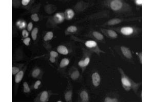 Immunofluorescent staining of HeLa cells. (Topo IIalpha (AA 1245-1361) 抗体)