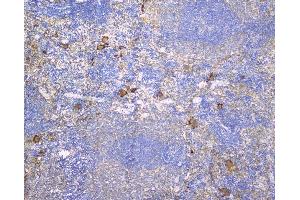 IHC analysis of CD229 using anti-CD229 antibody (ABIN6719290). (LY9 抗体)
