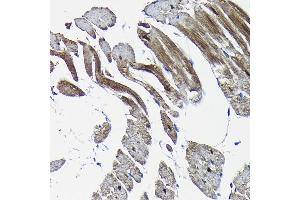 Immunohistochemistry of paraffin-embedded rat heart using Nesprin 1 Rabbit pAb (ABIN7270520) at dilution of 1:100 (40x lens). (SYNE1 抗体)