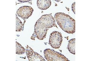 IHC analysis of PEF1 using anti-PEF1 antibody (ABIN6719632). (PEF1 抗体  (AA 170-284))