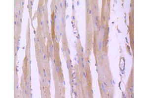 Immunohistochemistry of paraffin-embedded mouse heart using ROCK1 antibody (ABIN4905028) at dilution of 1:100 (40x lens). (ROCK1 抗体)