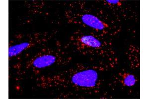 Proximity Ligation Analysis of protein-protein interactions between APPL1 and AKT1. (AKT1 抗体  (AA 381-480))