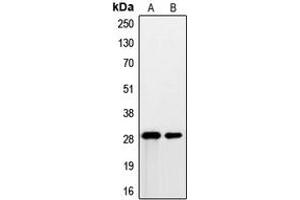 Western blot analysis of PSCA expression in DU145 (A), human prostate (B) whole cell lysates. (PSCA 抗体  (Center))