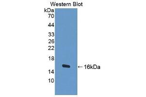 Detection of Recombinant BCHE, Human using Polyclonal Antibody to Butyrylcholinesterase (BCHE) (Butyrylcholinesterase 抗体  (AA 29-150))
