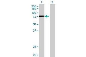 Lane 1: AKAP10 transfected lysate ( 72. (AKAP10 293T Cell Transient Overexpression Lysate(Denatured))
