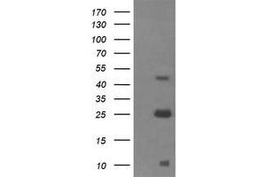 Western Blotting (WB) image for anti-Aldehyde Dehydrogenase 1 Family, Member A3 (ALDH1A3) (AA 1-100), (AA 413-512) antibody (ABIN1490538) (ALDH1A3 抗体  (AA 1-100, AA 413-512))