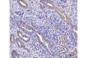 IHC analysis of RPL29 using anti-RPL29 antibody (ABIN7600993). (RPL29 抗体  (AA 27-153))