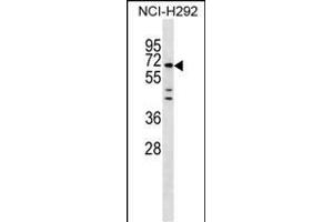 MIER3 Antibody (Center) (ABIN1538243 and ABIN2849902) western blot analysis in NCI- cell line lysates (35 μg/lane). (MIER3 抗体  (AA 284-312))