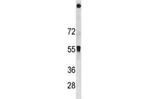 SQSTM1 antibody western blot analysis in HeLa lysate.