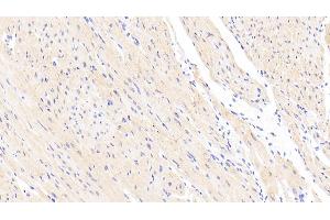 Detection of CNN2 in Human Cardiac Muscle Tissue using Polyclonal Antibody to Calponin 2 (CNN2) (CNN2 抗体  (AA 1-269))