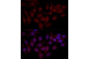 Confocal immunofluorescence analysis of Hela cells using EIF6 antibody (ABIN3022602, ABIN3022603, ABIN3022604 and ABIN6218936) at dilution of 1:50.