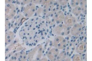 DAB staining on IHC-P; Samples: Rat Kidney Tissue (ROS1 抗体  (AA 1937-2210))
