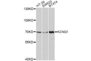 Western Blotting (WB) image for anti-Potassium Voltage-Gated Channel, KQT-Like Subfamily, Member 1 (KCNQ1) (AA 250-549) antibody (ABIN3023121)