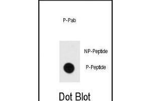 Dot blot analysis of anti-Phospho-MBP- Antibody (ABIN389939 and ABIN2839752) on nitrocellulose membrane. (MBP 抗体  (pTyr203))