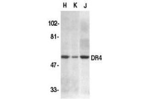Western blot analysis of DR4 in HeLa (H), K562 (K), and Jurkat (J) whole cell lysate with AP30300PU-N DR4 antibody at 1/500 dilution. (TNFRSF10A 抗体  (N-Term))