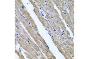 Immunohistochemistry of paraffin-embedded rat heart using DFNA5 antibody at dilution of 1:100 (x40 lens). (DFNA5 抗体)