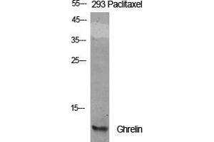 Western Blot (WB) analysis of specific cells using Ghrelin Polyclonal Antibody. (Ghrelin 抗体  (Internal Region))