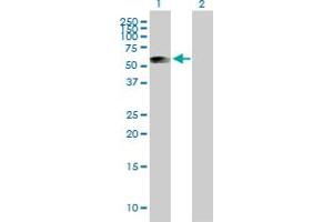 Western Blot analysis of ATP5B expression in transfected 293T cell line by ATP5B MaxPab polyclonal antibody. (ATP5B 抗体  (AA 1-529))