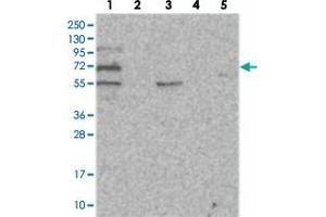 Western blot analysis of Lane 1: RT-4, Lane 2: U-251 MG, Lane 3: Human Plasma, Lane 4: Liver, Lane 5: Tonsil with SOWAHB polyclonal antibody . (SOWAHB 抗体)