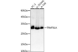 Western blot analysis of extracts of various cell lines, using TRMT61A antibody (ABIN6132806, ABIN6149558, ABIN6149559 and ABIN6214904) at 1:1000 dilution. (TRMT61A 抗体  (AA 1-289))