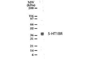 Image no. 1 for anti-Serotonin Receptor 1B (HTR1B) (AA 8-26) antibody (ABIN208265) (5HT1B Receptor 抗体  (AA 8-26))