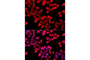 Immunofluorescence analysis of A549 cells using XRCC6 antibody. (XRCC6 抗体  (AA 408-609))