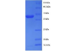 SDS-PAGE (SDS) image for Ribosomal Protein S19 Binding Protein 1 (RPS19BP1) (AA 1-145), (full length) protein (GST tag) (ABIN7479589) (RPS19BP1 Protein (AA 1-145, full length) (GST tag))