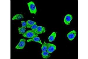 Confocal immunofluorescent analysis of DJ-1 antibody with HeLa cells followed by Alexa Fluor 488-conjugated goat anti-rabbit lgG (green). (PARK7/DJ1 抗体  (AA 1-30))