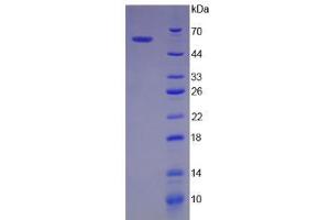 SDS-PAGE analysis of Human BIRC2 Protein. (BIRC2 蛋白)