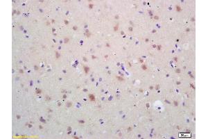 Formalin-fixed and paraffin embedded rat brain labeled with Rabbit Anti HSP60 Polyclonal Antibody, Unconjugated (ABIN726080) at 1:200 followed by conjugation to the secondary antibody and DAB staining (HSPD1 抗体  (AA 501-573))