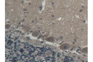 DAB staining on IHC-P; Samples: Porcine Cerebellum Tissue (Coagulation Factor V 抗体  (AA 1941-2095))