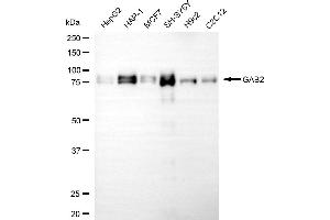 Western blotting analysis using GAB2 antibody (ABIN7798802).