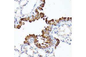 Immunohistochemistry of paraffin-embedded mouse lung using SMYD4 antibody (ABIN6133038, ABIN6148171, ABIN6148172 and ABIN6223147) at dilution of 1:100 (40x lens). (SMYD4 抗体  (AA 1-260))