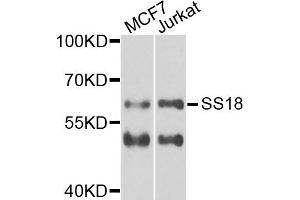 Western blot analysis of extracts of MCF7 and Jurkat cells, using SS18 antibody. (SS18 抗体)