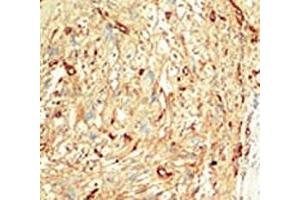 Immunohistochemistry (IHC) image for anti-serine/threonine Kinase 4 (STK4) (AA 385-415) antibody (ABIN3032542)