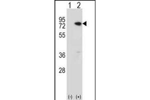 Western blot analysis of MeCP2 (arrow) using rabbit polyclonal MeCP2 Antibody  (ABIN650709 and ABIN2839306). (MECP2 抗体  (C-Term))