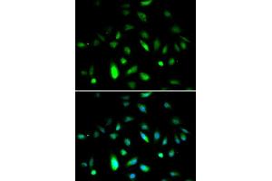 Immunofluorescence analysis of A549 cell using CCNB1 antibody. (Cyclin B1 抗体  (C-Term))