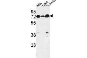 Western Blotting (WB) image for anti-Lipid Phosphate Phosphatase-Related Protein Type 4 (LPPR4) antibody (ABIN3002187) (LPPR4 抗体)