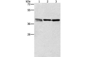 Western Blot analysis of A549, K562 and PC3 cell using ZFP42 Polyclonal Antibody at dilution of 1:500 (ZFP42 抗体)