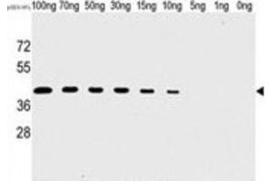Western Blotting (WB) image for anti-Tyr/ser Protein Phosphatase antibody (ABIN2995280) (Tyr/ser Protein Phosphatase 抗体)