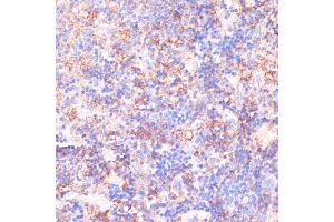 Immunohistochemistry (IHC) image for anti-Calcium Channel, Voltage-Dependent, beta 2 Subunit (CACNB2) (AA 481-660) antibody (ABIN7266010)