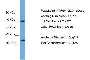 WB Suggested Anti-ATP6V1G2  Antibody Titration: 0. (ATP6V1G2 抗体  (Middle Region))