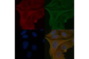 CEP27 Mouse Monoclonal Antibody staining Hela cells by IF/ICC.