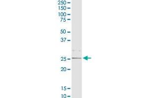 Western Blotting (WB) image for anti-Complement Component 1, Q Subcomponent, B Chain (C1QB) (AA 1-253) antibody (ABIN513854)