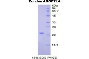 SDS-PAGE analysis of Pig ANGPTL4 Protein. (ANGPTL4 蛋白)