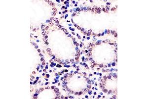 Immunohistochemistry (Paraffin-embedded Sections) (IHC (p)) image for anti-DNA (Cytosine-5)-Methyltransferase 1 (DNMT1) (AA 881-914) antibody (ABIN6243160)